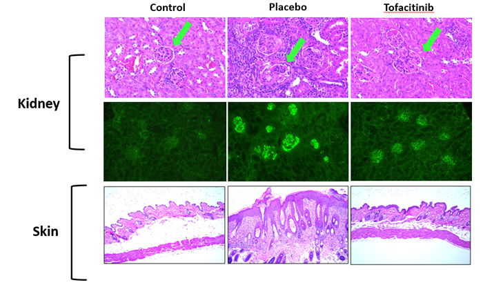 Image of skin and kidney cells treated and untreated with tofacitinib