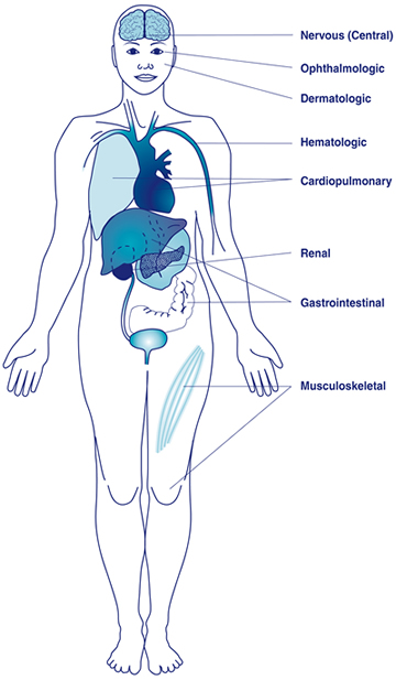 Anatomical illustration showing parts of the body which might be affected by lupus