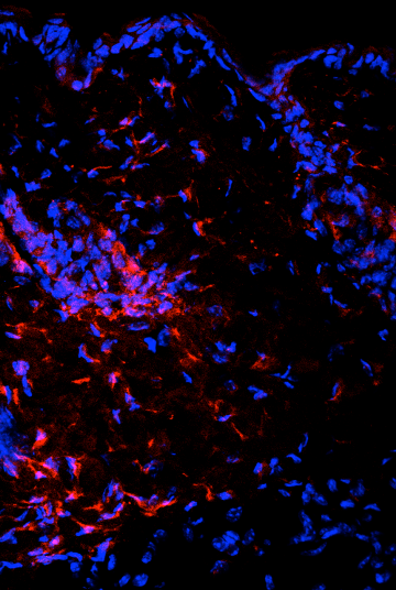 immune cells (red) in skin from the sclerodermic mice