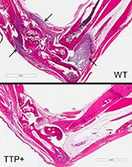Stained sections of foot joints from mice