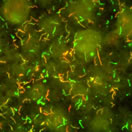immunofluorescent antibodies bind to surface proteins on the bacterium that causes Lyme disease, producing fluorescent yellow, red and green hues