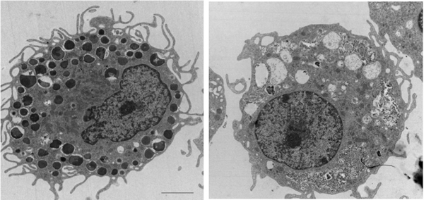 Mast cells harbor dozens of histamine-laden granules (left) but when stimulated by delta toxin (right) the granules are expelled into the cell’s surroundings. Credit: Gabriel Núñez, M.D., University of Michigan Health System.
