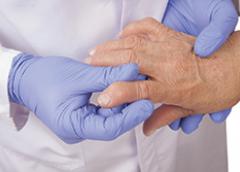 hand with Rhuematoid Arthritis