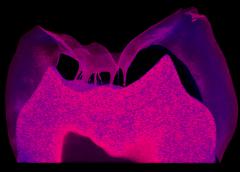 Finger-like projections (magenta) into a tooth’s top layer represent damage to the enamel of a person with a keratin 75 mutation.