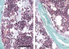 Microscope image of bone-forming osteoblasts (light pink) appear on bone (blue) surfaces.