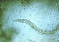 Photo of a helminth worm.