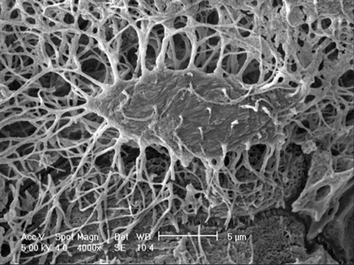 microscopic view of bone cells