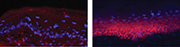 Disease-causing antibody (red) levels are lessened by treatment with engineered T cells (left panel) compared to controls (right panel) in mucous membrane samples taken from mice