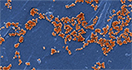 Scanning electron microscopic image of Staphylococcus aureus bacteria