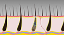 hair structure under skin infographic