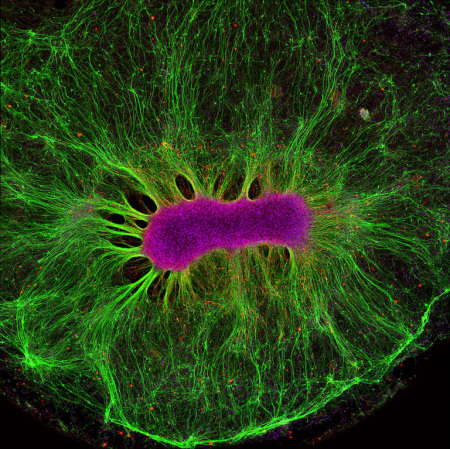 A mini-brain organoid, the center consisting of a clump of neuronal bodies (magenta) surrounded by an intricate network of branching extensions (green) through which these cells relay information.