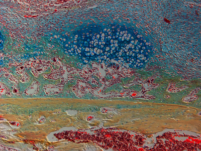 Microscopic view of bone cells