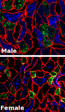 calf muscle fibers in male and female rats
