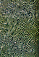Microscopic cells.