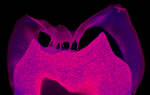 Finger-like projections (magenta) into a tooth’s top layer represent damage to the enamel of a person with a keratin 75 mutation