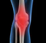 x-ray of joints
